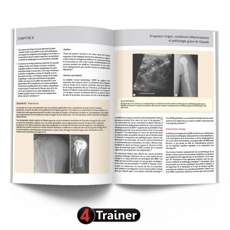 L'Épaule - 4TRAINER EDITIONS 7 L'Épaule - 4TRAINER EDITIONS – Image 7