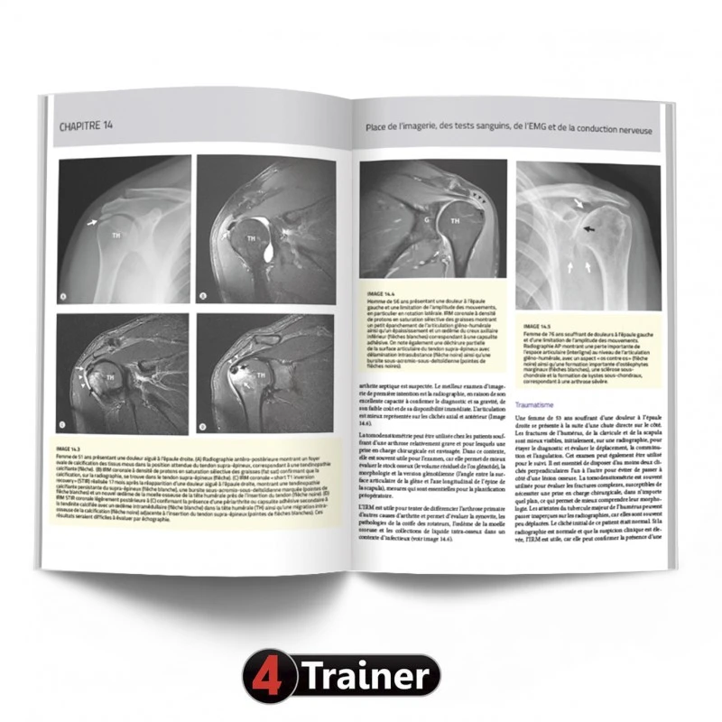 L'Épaule - 4TRAINER EDITIONS 9 L'Épaule - 4TRAINER EDITIONS – Image 9